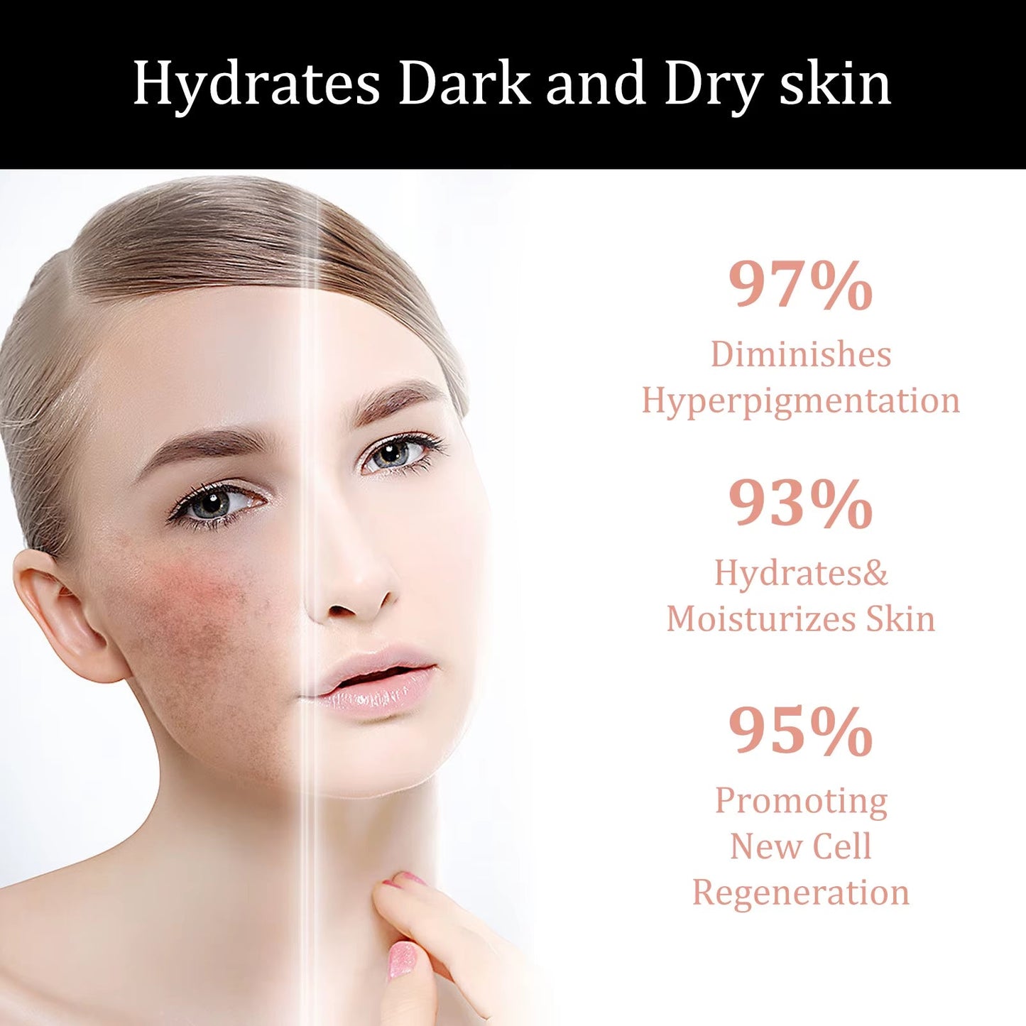 Melanin Correcting Serum Fade Dark Spots anti Freckle Melasma Remover Lightening Pigment Blemish Vitamin C Face Essence